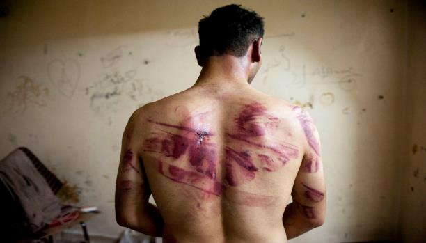 مقتل 14 شخصاً بسبب التعذيب في سجون النظام خلال أيار الماضي